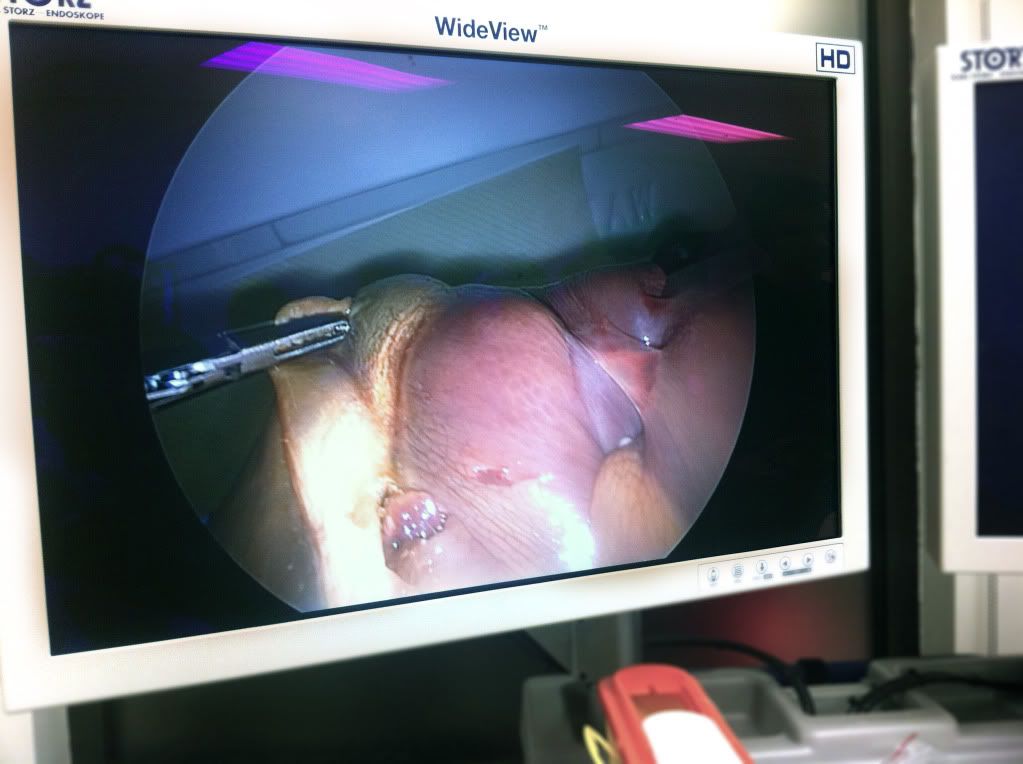 common bile duct diagram. pictures Hepatic duct and