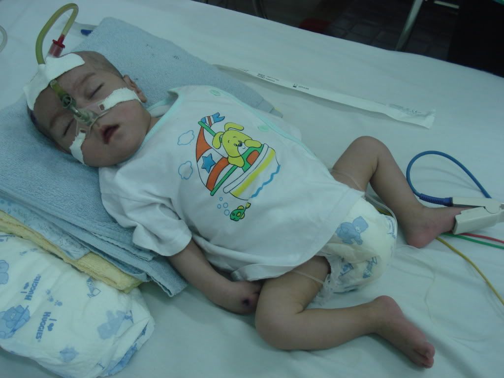 Cứu bé Khánh Hùng 2 tháng tuổi cần 65tr mổ tim gấp vào 30/6 - 3