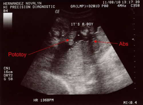 ultrasound